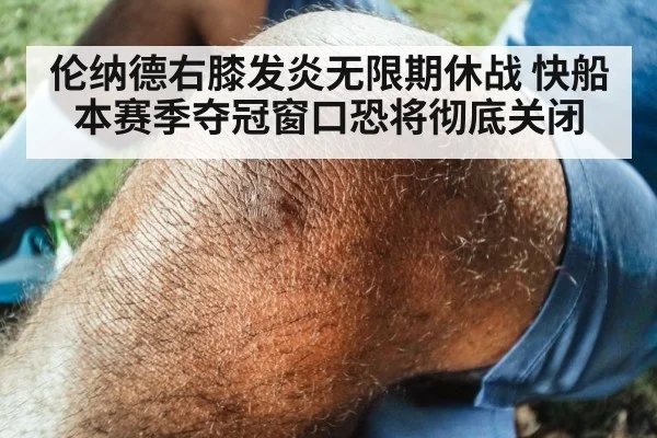 伦纳德右膝发炎无限期休战 快船本赛季夺冠窗口恐将彻底关闭